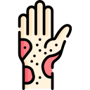 Anti-Inflammatory